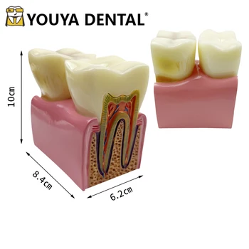 Сравнительные модели анатомии зубов Анатомия Коренных зубов Модель для обучения студентов-стоматологов-техников Практика Обучение